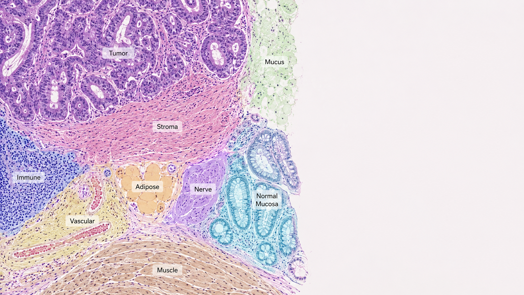 Colorectal tissue classes