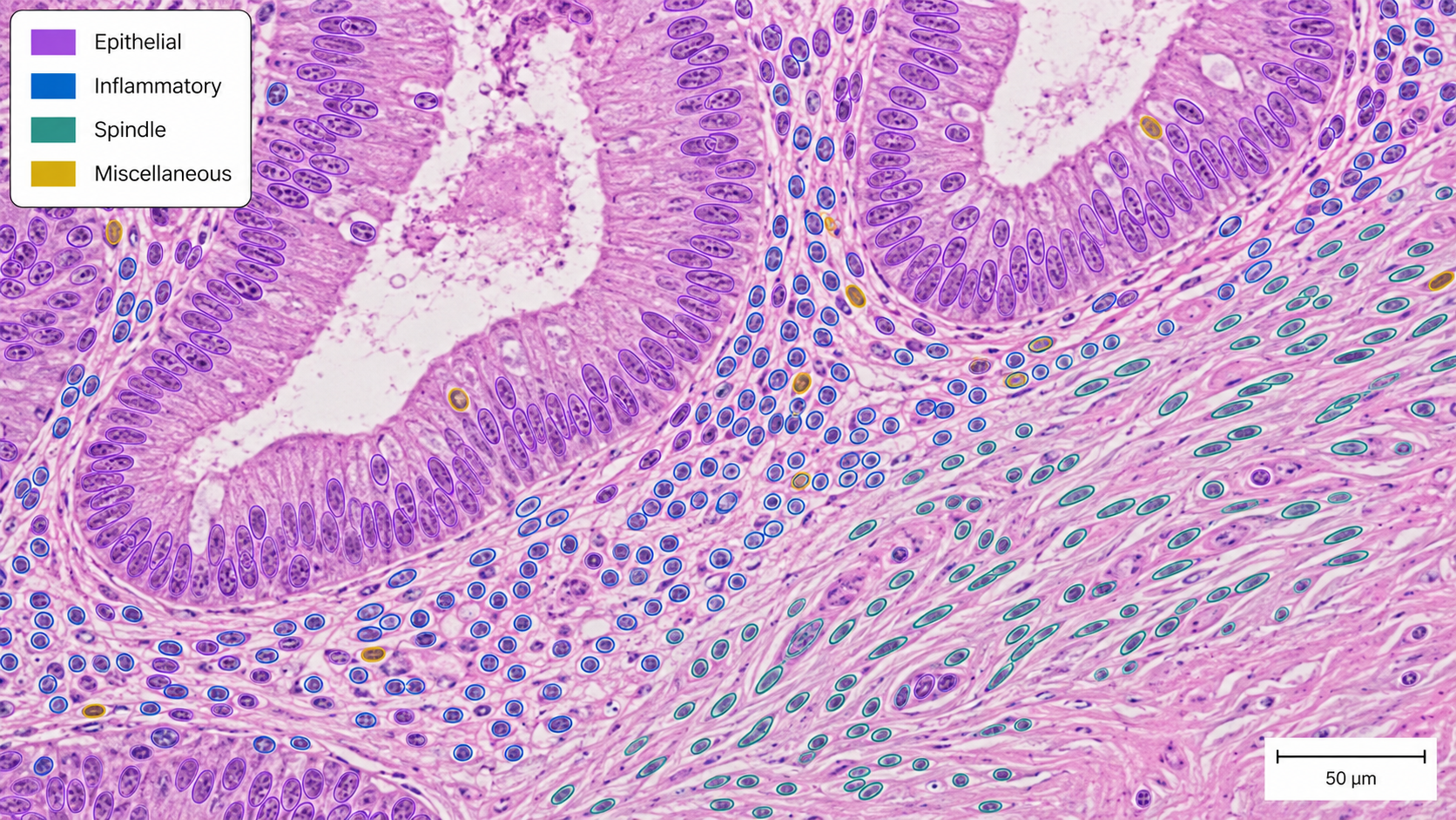 Nuclei segmentation and typing